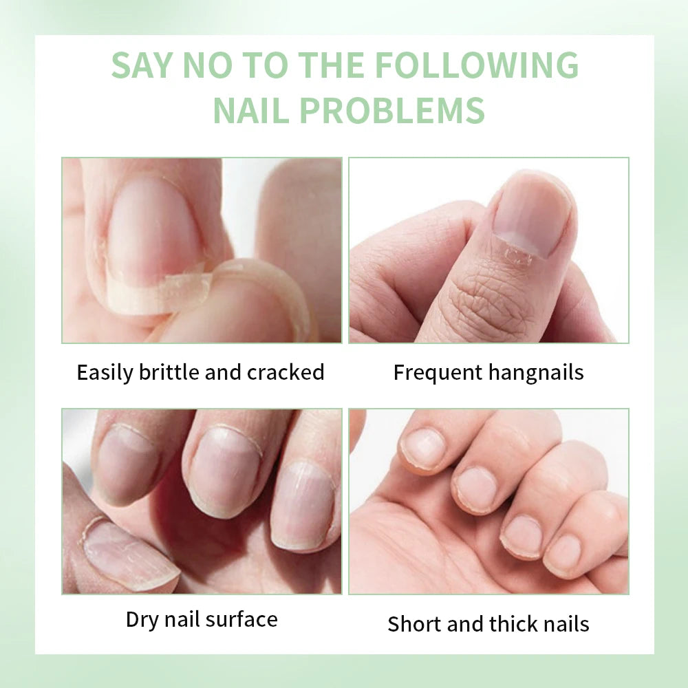 Tratamiento Fortalecedor de Uñas – Crecimiento y Salud Natural