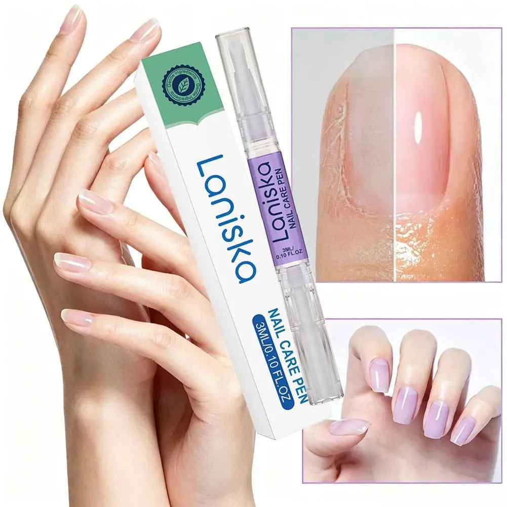 Aceite Anti-Barb para Cutículas – Tratamiento Nutritivo con Pluma